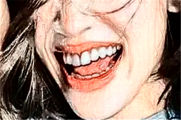 北京牙管家口腔診所冷光美白費用多少?整形日記全過程