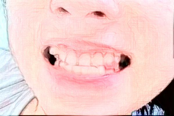 深圳樂莎莎口腔醫(yī)院醫(yī)生怎么樣?2024牙齒矯正怎么收費