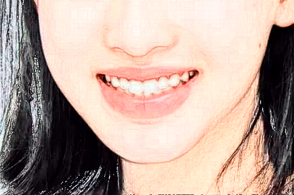 重慶團(tuán)圓口腔醫(yī)院矯正牙齒怎么樣?矯正牙齒要多久