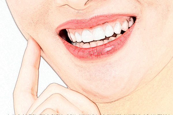 武漢德韓口腔醫(yī)療洗牙怎么洗的?附洗牙案例