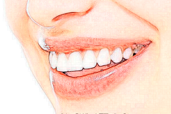 宣城大醫(yī)醫(yī)院全瓷牙能用多久?全瓷牙能維持多長時間