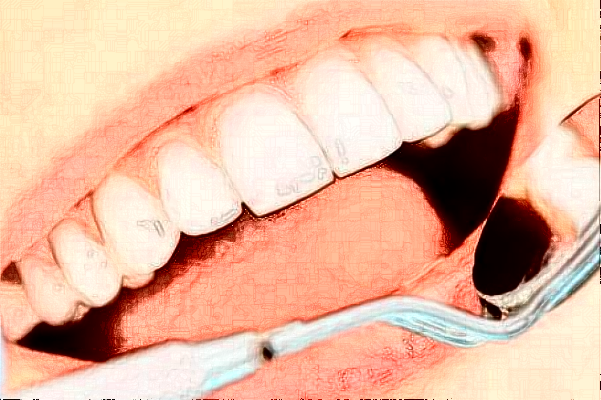 2024襄陽(yáng)新德恩口腔門診部牙齒矯正費(fèi)用多少_真實(shí)案例反饋