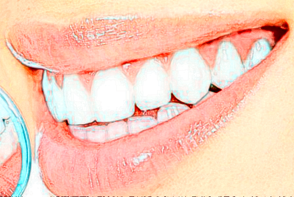 2024襄陽(yáng)新德恩口腔門診部牙齒矯正費(fèi)用多少_真實(shí)案例反饋