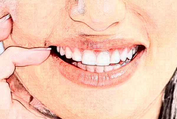 2024福州美橙口腔美學(xué)修復(fù)好不好?附術(shù)后案例參考!