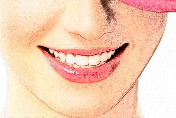 延安牙衛(wèi)士口腔正畸費用多少_醫(yī)生名單