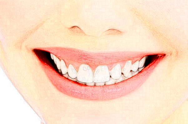 2024山東鉑爾口腔根管好不好?附術(shù)后案例參考!