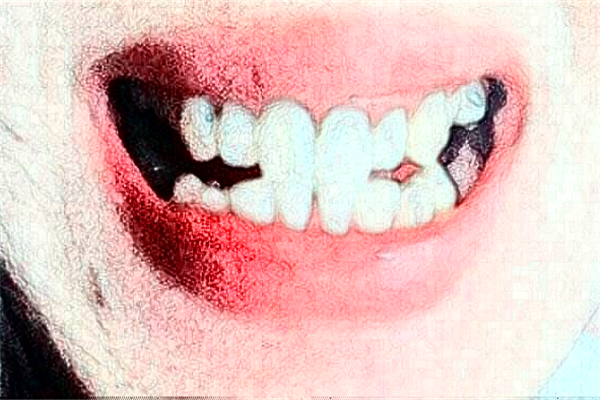 重慶齊美口腔門診部烤瓷牙價(jià)目表(價(jià)格表)_口碑怎么樣