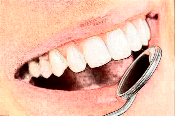 重慶齊美口腔門診部烤瓷牙價(jià)目表(價(jià)格表)_口碑怎么樣