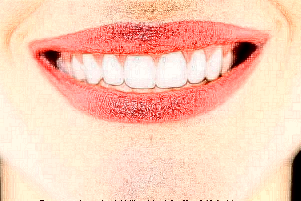 2024上海華美醫(yī)療美容醫(yī)院種植一顆牙多少錢_做的怎么樣