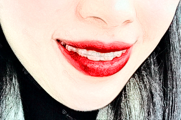 武漢德韓口腔醫(yī)療補牙的步驟有哪些?2024補牙價格公布