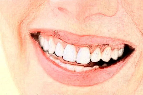 2024宣城大醫(yī)醫(yī)院牙齒矯正多少錢?牙齒矯正后遺癥和危害