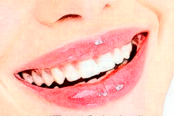 義烏傅氏口腔門診部拔牙痛不痛?拔牙需要多少時(shí)間