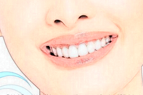 義烏傅氏口腔門診部矯正牙齒怎么樣?矯正牙齒要多久