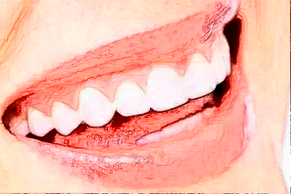 贛州貝殼口腔拔牙怎么樣，附醫(yī)生信息一覽~