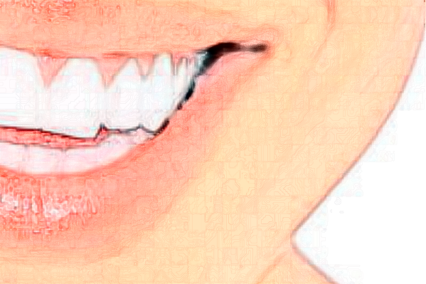 贛州貝殼口腔拔牙怎么樣，附醫(yī)生信息一覽~