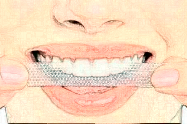 2024襄陽新德恩口腔門診部美容冠好嗎_真實案例發(fā)布