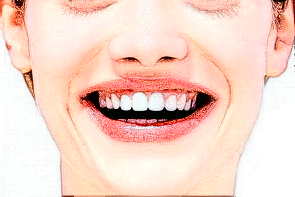 2024福州登特口腔醫(yī)院正畸怎么樣_體驗(yàn)日記分享