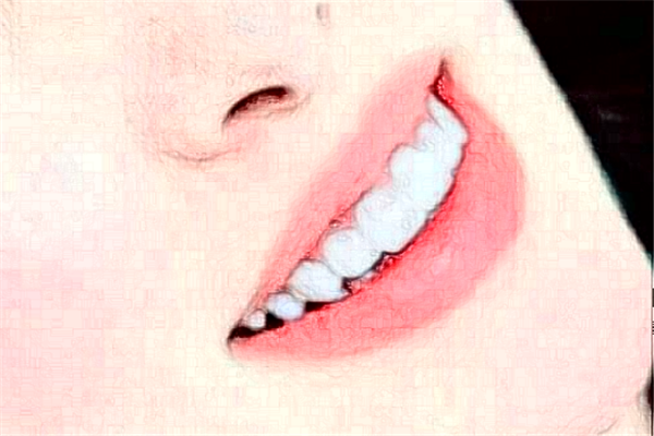 淮安諾貝爾口腔醫(yī)院冷光美白怎么樣?哪個醫(yī)生好+價格