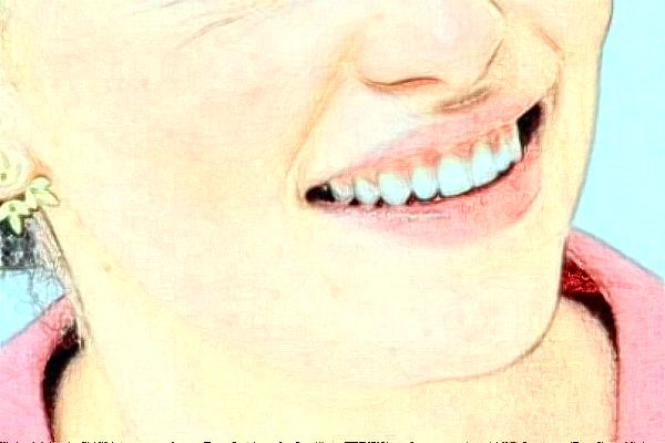 淮安諾貝爾口腔醫(yī)院隱形矯正怎么樣，附醫(yī)生信息一覽~