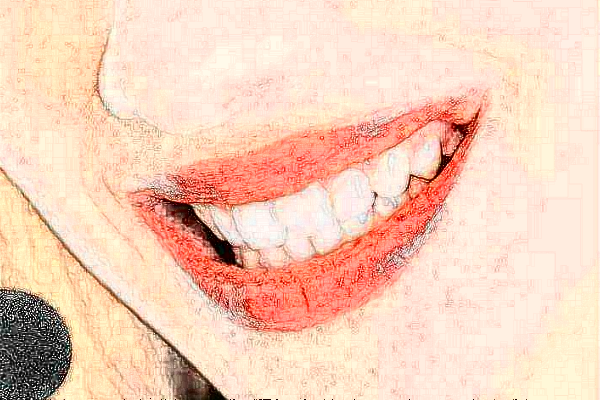 福州美橙口腔牙齒美白怎么樣，附醫(yī)生信息一覽~