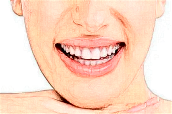 2024淮安諾貝爾口腔醫(yī)院全瓷牙好不好?附術(shù)后案例參考!