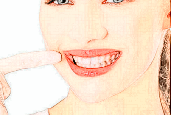 2024義烏傅氏口腔門(mén)診部隱適美價(jià)格?隱適美的缺點(diǎn)