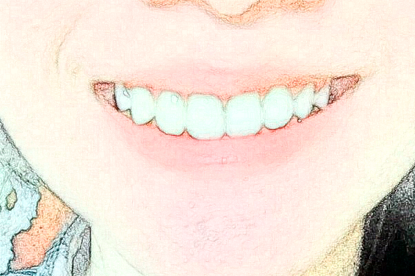 義烏傅氏口腔門診部怎么樣?2024牙齒矯正多少錢