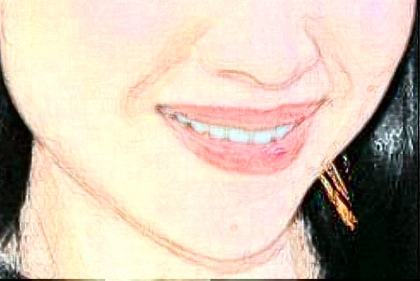 重慶團圓口腔醫(yī)院拔智齒價格?拔智齒好處和壞處