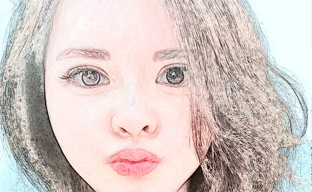 上海瑰麗醫(yī)療美容門診部打玻尿酸術(shù)后三個(gè)月求美案例|技術(shù)亮點(diǎn)怎么樣?需要多少錢