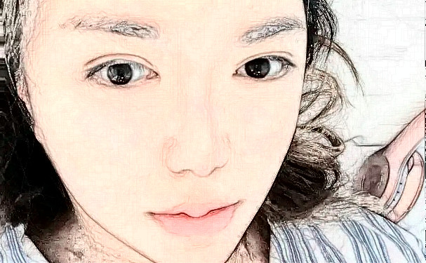 銀川百思美整形醫(yī)院激光除皺需要多少錢(qián)?90天術(shù)后恢復(fù)案例