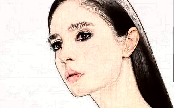 東莞韓美美容醫(yī)院頸部除皺術(shù)后半年野生案例&技術(shù)怎么樣?