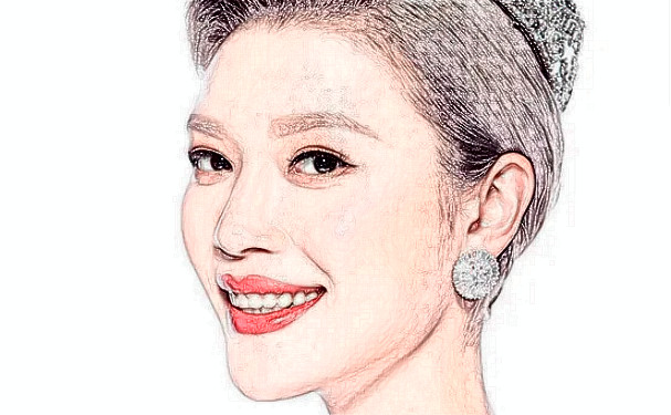 麗水黃君曼整形醫(yī)院去頸紋技術(shù)怎么樣?費(fèi)用查詢(xún)?半年親測(cè)案例全解