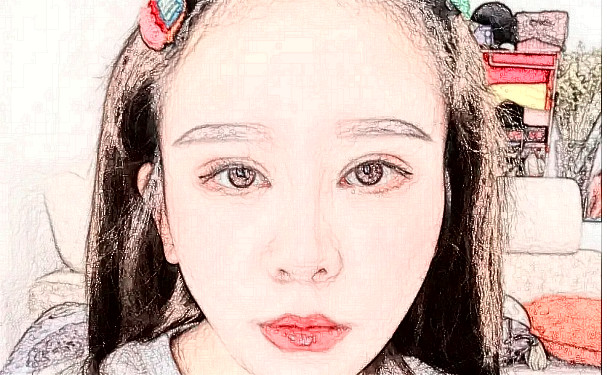 長沙麗臻醫(yī)療美容門診激光除皺技術(shù)等級怎么樣?術(shù)后90天案例&價格