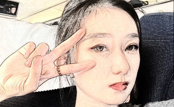 蕪湖美人魚整形醫(yī)院激光去皺紋120天野生案例|技術(shù)亮點(diǎn)怎么樣?價(jià)格查詢