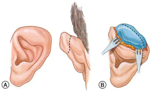 華中科技大學同濟醫(yī)學院醫(yī)院杯狀耳整形價格一覽表?技術(shù)風格怎么樣?