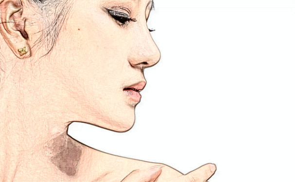 武漢市武昌醫(yī)院整形科招風(fēng)耳整形怎么樣?多少錢?案例曝光&技術(shù)等級