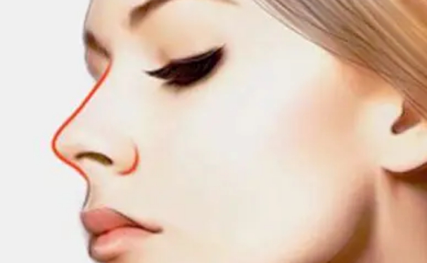 西寧華美整形醫(yī)院鼻整形多少錢?技術級別&120天案例點評