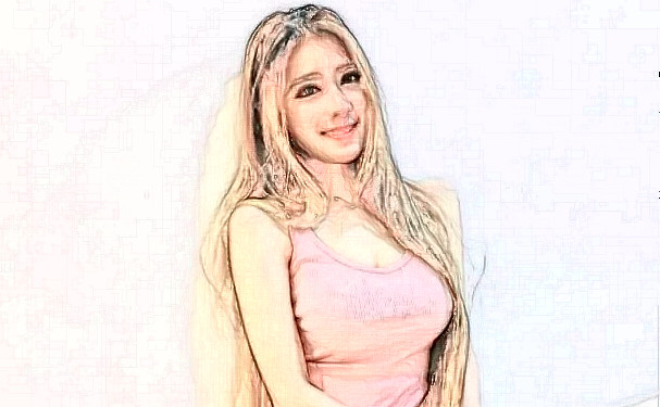 上海容妍醫(yī)療美容門(mén)診部玻尿酸隆胸術(shù)后半年案例欣賞&報(bào)價(jià)多少?