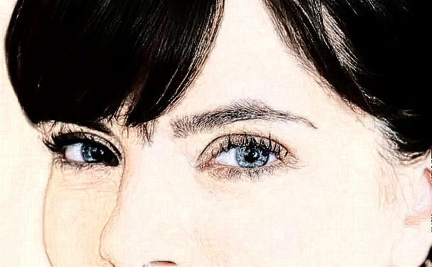 赤峰紅山中醫(yī)院美容科做雙眼皮價格表?術后三個月求美案例