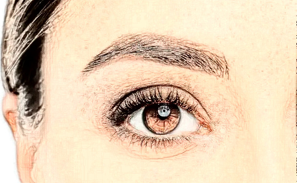 寧波壬美整形醫(yī)院做雙眼皮技術特點怎么樣?120天經典案例