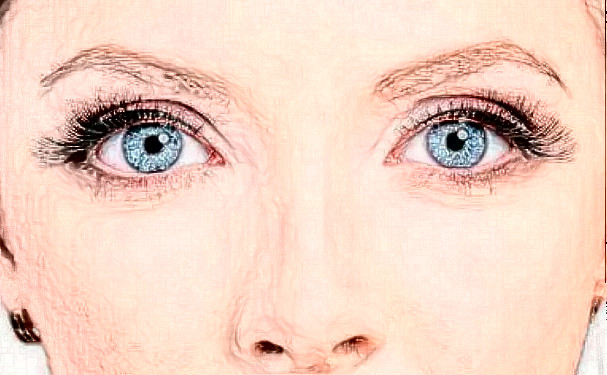 上海伊萊美整形醫(yī)院開雙眼皮術(shù)后三個(gè)月案例欣賞(效果怎么樣?技術(shù)水準(zhǔn))