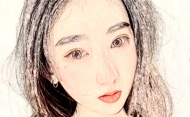 南寧農(nóng)霖整形醫(yī)院植發(fā)技術(shù)怎么樣?術(shù)后三個(gè)月案例點(diǎn)評(píng)