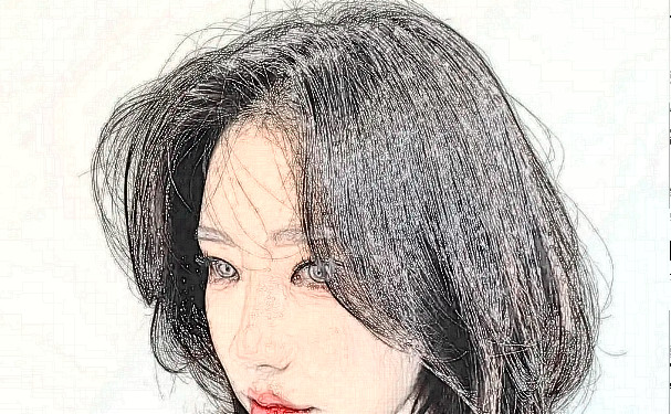 南寧農(nóng)霖整形醫(yī)院植發(fā)技術(shù)怎么樣?術(shù)后三個(gè)月案例點(diǎn)評(píng)