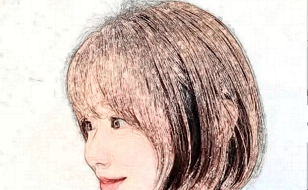 重慶重生醫(yī)院疤痕植發(fā)一年術后案例反饋|技術亮點怎么樣?收費標準