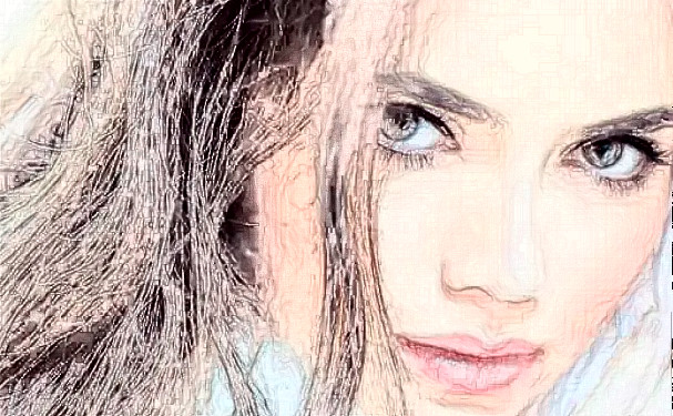 成都武侯艾米麗醫(yī)療美容門診部植發(fā)技術怎么樣?術后半年經(jīng)典案例