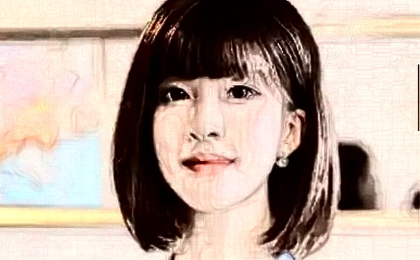 菏澤華美醫(yī)療美容門診部植發(fā)120天求美案例|技術(shù)評價怎么樣?價目一覽表