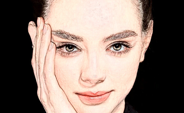 Loveme樂美整形臉部脂肪填充技術(shù)怎么樣?術(shù)后半年案例點評|費用多少