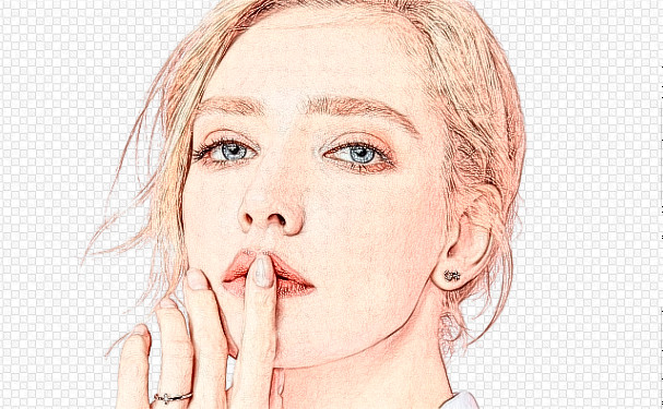 重慶沙坪壩星藝美醫(yī)療美容門(mén)診部脂肪填充整形術(shù)后一年求美案例&需要多少錢(qián)?