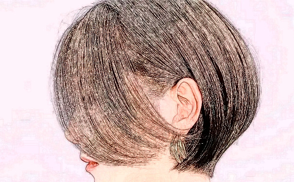 南昌萊美美容醫(yī)院植發(fā)費用明細(xì)?半年案例恢復(fù)過程