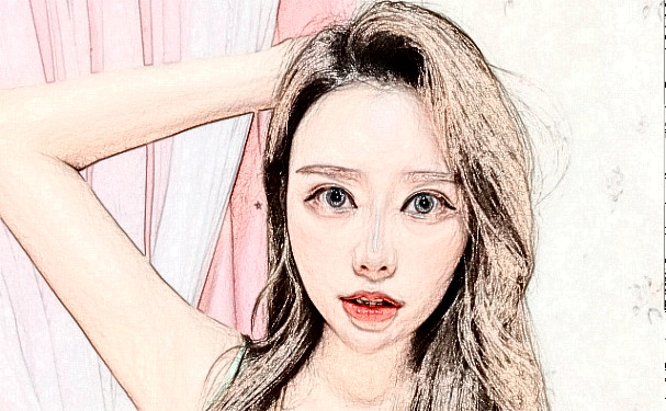 泉州豐澤西華醫(yī)療美容門診部臉部脂肪填充費(fèi)用明細(xì)?術(shù)后三個(gè)月案例反饋